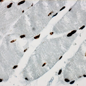 Hsa miR-1 Probe for FISH Assay