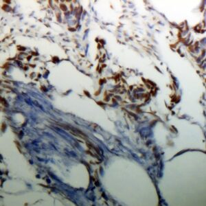 Hsa-miR-19b-3p Probe