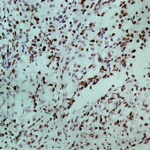 Hsa miR-100 Probe for FISH Assay