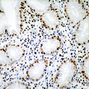 Hsa Mir 101 3p Probe for ISH / FISH Assays