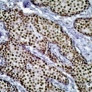 Hsa-miR-151a-3p Probe