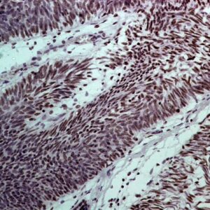 Hsa-miR-183-3P Probe