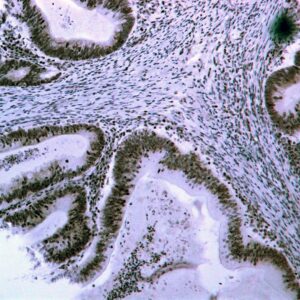 Hsa-miR-193A-3P Probe