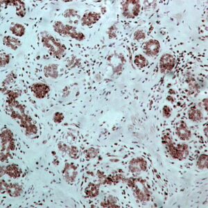 Hsa miR-195 Probe for FISH Assay