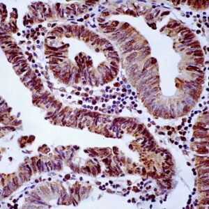 Hsa-miR-221-3p Probe