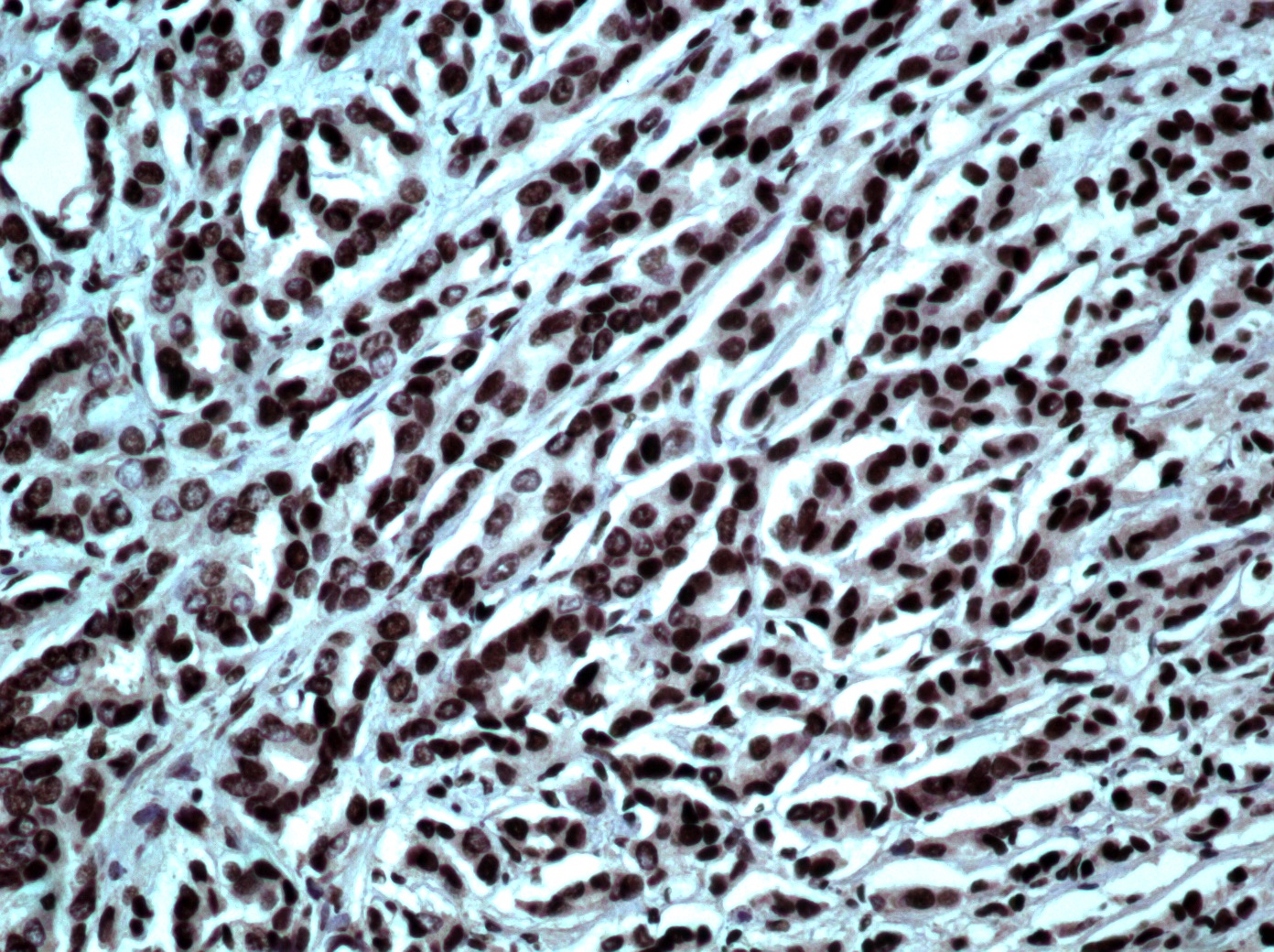 Hsa-miR-331-3p Probe