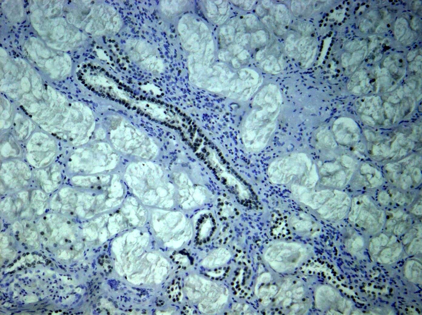 Hsa-miR-339-3P Probe