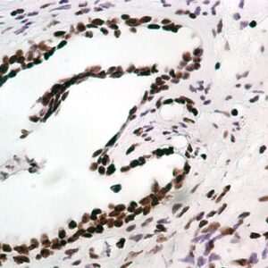 Hsa-miR-342-3P Probe