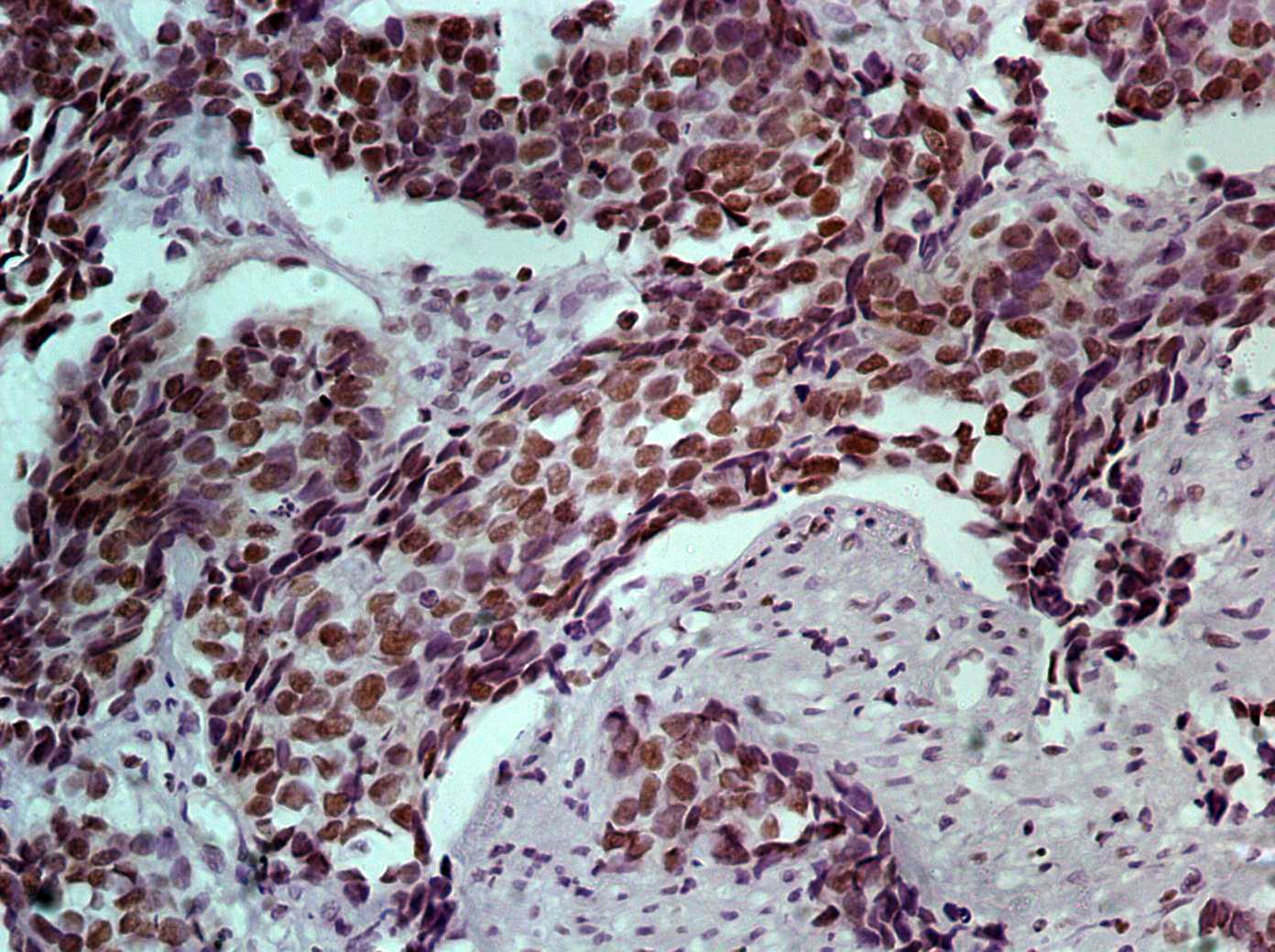 Hsa-miR-365A-3P Probe