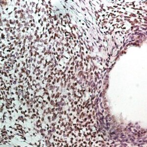 Hsa miR-372 Probe for FISH Assay