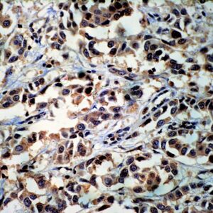 Hsa-miR-423-3p Probe