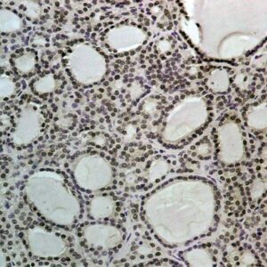 Hsa-miR-450B-3P Probe