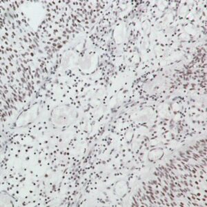 Hsa-miR-486-3P Probe