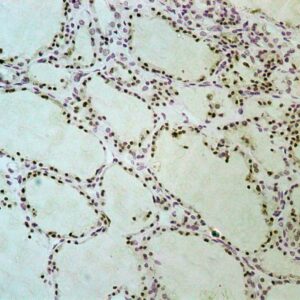 Hsa-miR-517A-3P Probe