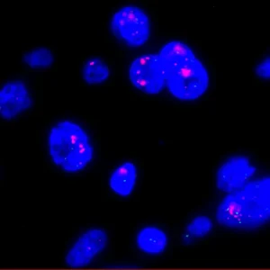 eFISH CEN 17/HER2 Dual Color Probe