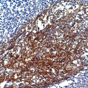 Anti-C4D, Clone Polyclonal