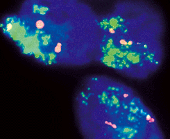 eFISH MDM2/CEN 12 Dual Color Probe