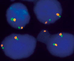 eFISH p16/CEN 9 Dual Color Probe