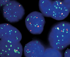 eFISH FGFR1/CEN 8 Dual Color Probe