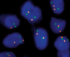 eFISH NMYC/2q11 Dual Color Probe