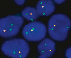 eFISH 1p36/1q25 Dual Color Probe