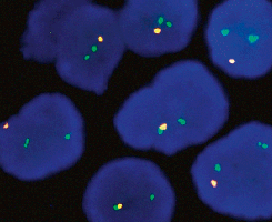 eFISH 19q13/19p13 Dual Color Probe