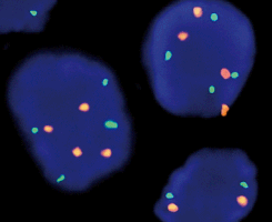 eFISH MET/CEN 7 Dual Color Probe