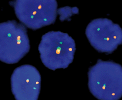 eFISH EWSR1 Dual Color Break Apart Probe