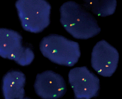 eFISH CHOP Dual Color Break Apart Probe