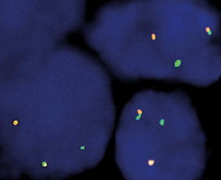 eFISH TFE3 Dual Color Break Apart Probe