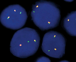 eFISH ALK Dual Color Break Apart Probe