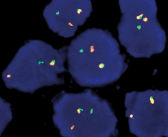 eFISH FUS Dual Color Break Apart Probe