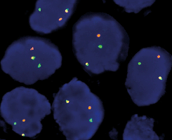 eFISH ROS1 Dual Color Break Apart Probe