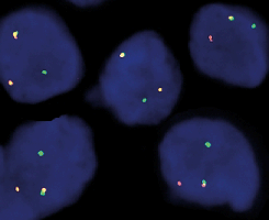 eFISH RET Dual Color Break Apart Probe