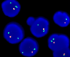 eFISH TP53/CEN 17 Dual Color Probe