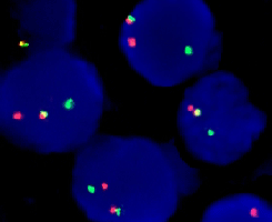 eFISH CMYC Dual Color Break Apart Probe