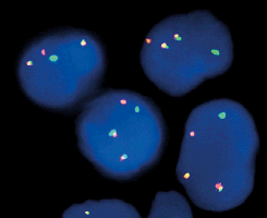 eFISH CMYC/IGH Dual Color Dual Fusion Probe