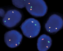 eFISH EGR1/5p15 Dual Color Probe