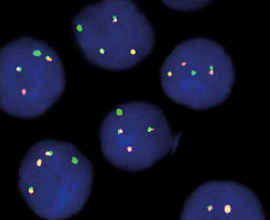 eFISH BCR/ABL Dual Color Dual Fusion Probe