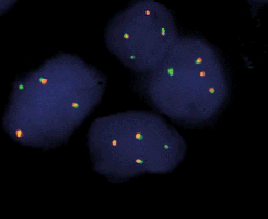 eFISH AML1/ETO Dual Color Dual Fusion Probe