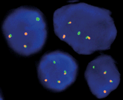 eFISH BCL2/IGH Dual Color Dual Fusion Probe