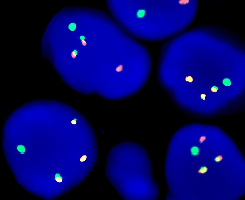 eFISH ETV6/RUNX1 Dual Color Dual Fusion Probe