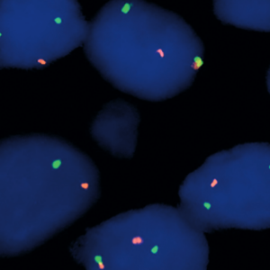 eFISH BCL6 Dual Color Break Apart Probe