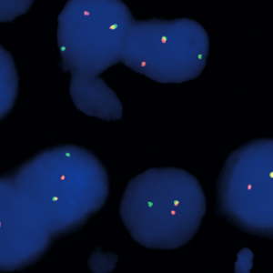 eFISH ETV6 Dual Color Break Apart Probe