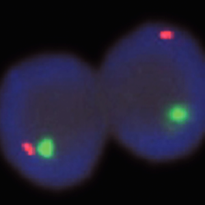 eFISH CEN X/Yq12 Dual Color Probe