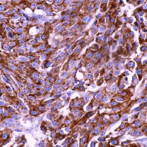 Anti-Melanoma Marker