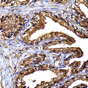Anti- PSAP, Clone PASE/4LJ