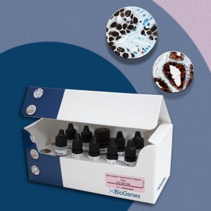 Super Sensitive<sup>TM</sup> Polymer HRP Kit <strong>Manual</strong> 