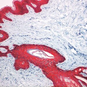 Anti-Cytokeratin Cocktail