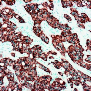 Anti-c-erbB-2 (Her-2/neu)